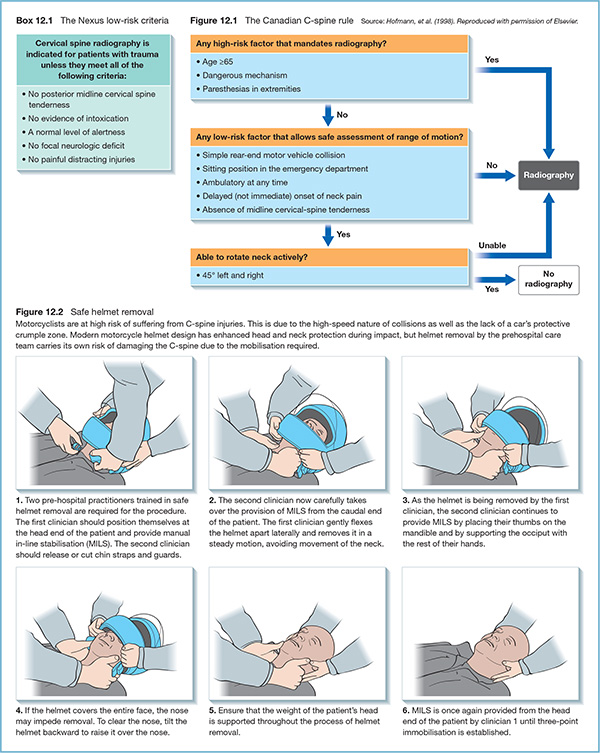 Cervical Spine Injuries Anesthesia Key