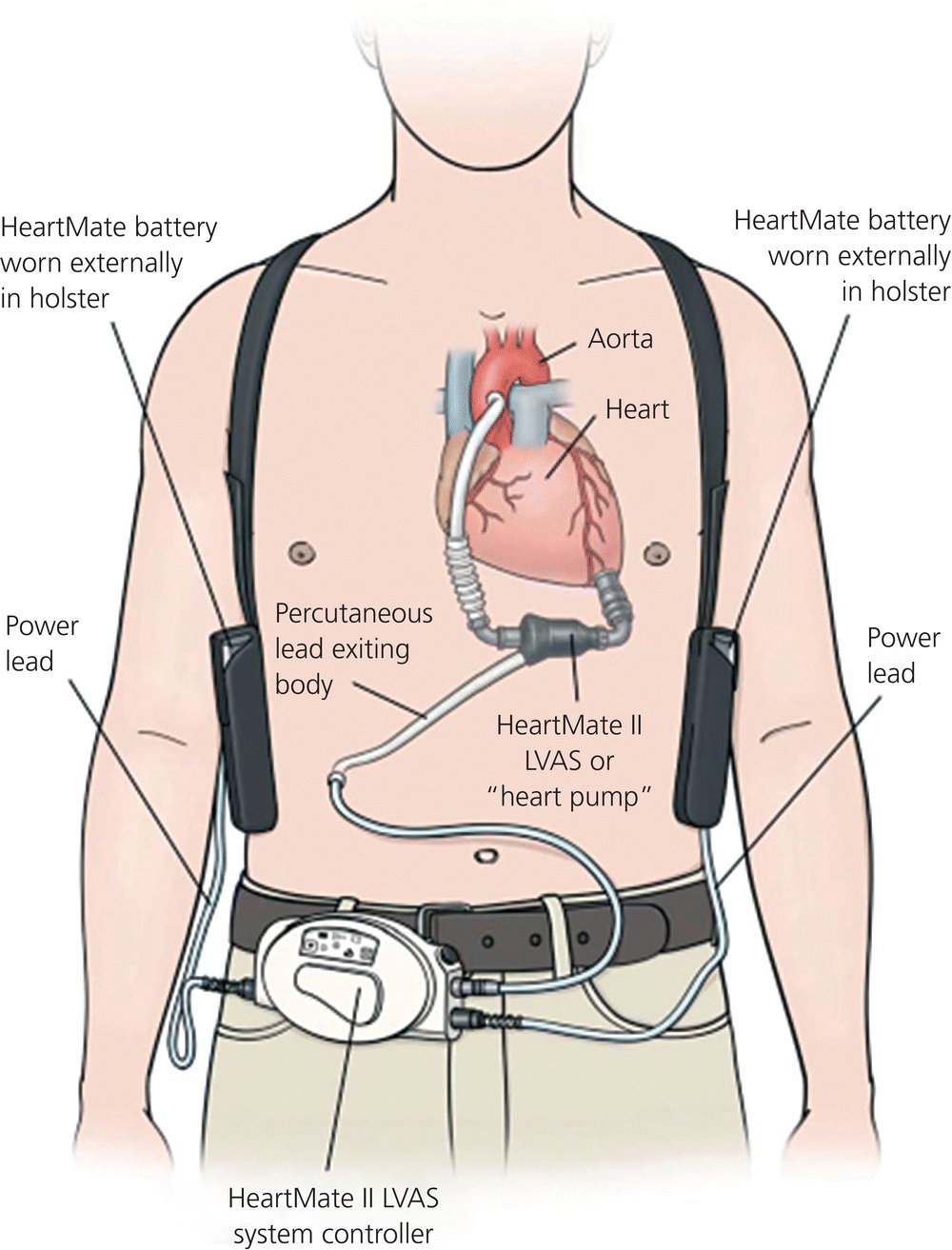 c15-fig-0001