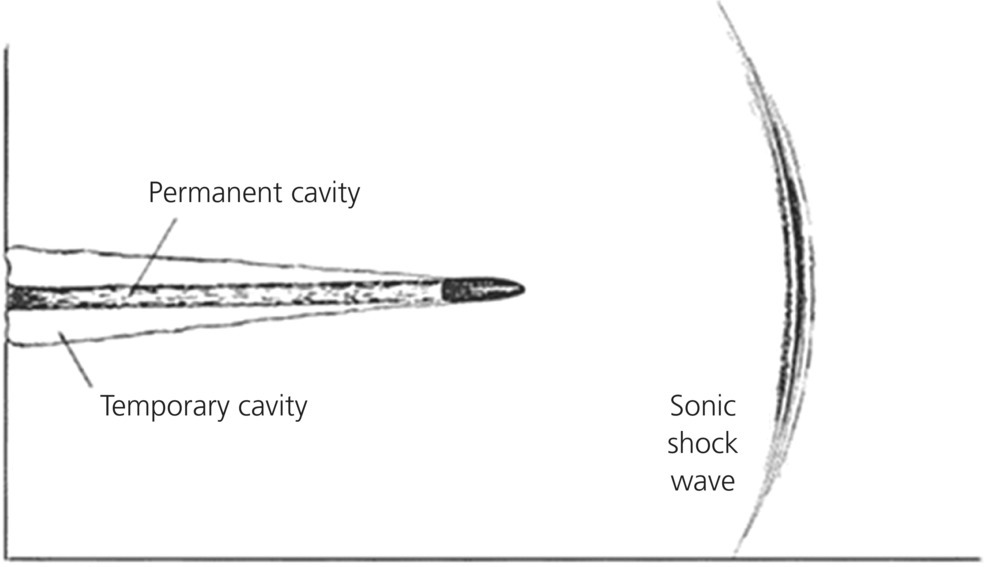 c29-fig-0002