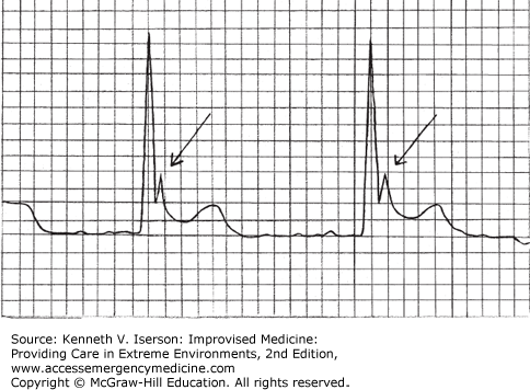 Vital Signs, Measurements, and Triage | Anesthesia Key