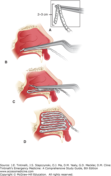 Nose and Sinuses | Anesthesia Key