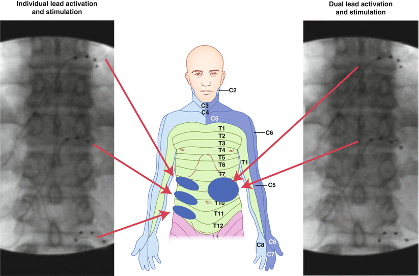 A159084_2_En_23_Fig3_HTML.gif