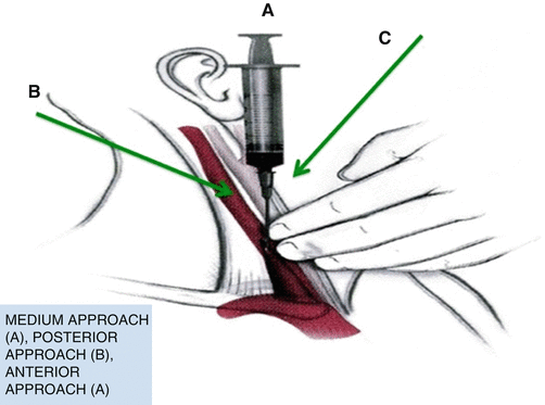 A330693_1_En_10_Fig2_HTML.gif