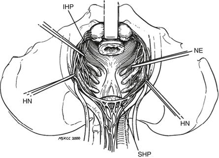 A330693_1_En_17_Fig2_HTML.gif