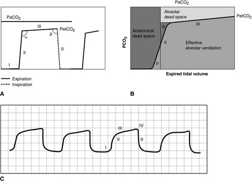 Capnography Monitoring | Anesthesia Key