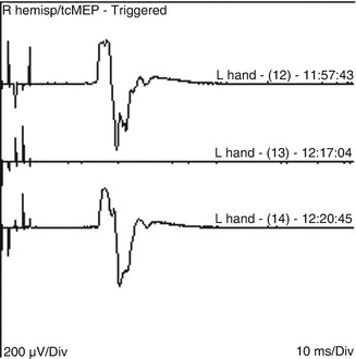 A210707_2_En_21_Fig2_HTML.gif