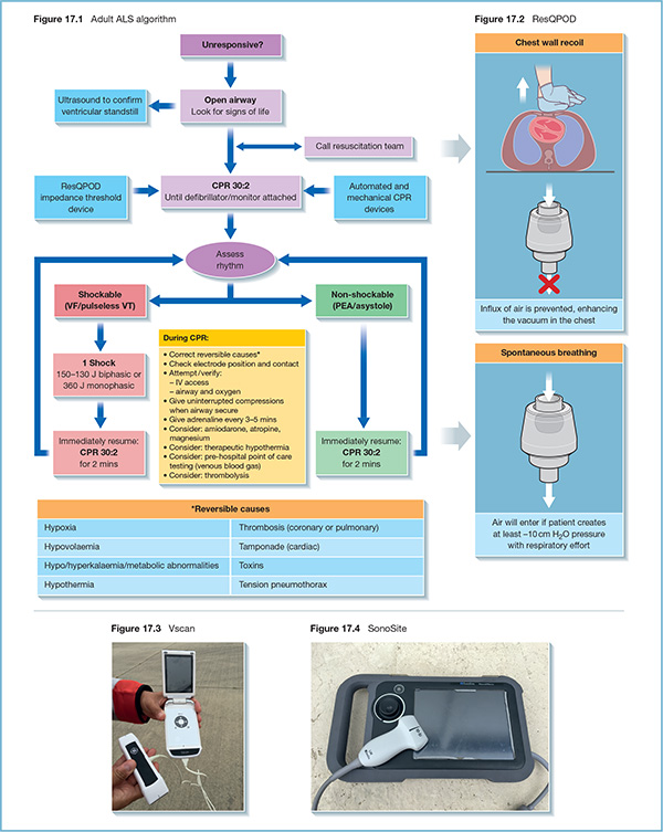 Chart shows algorithm of adult ALS with markings for unresponsive, open airway, call resuscitation team, CPR 30:2, assess rhythm, shockable, non-shockable, 1 shock, et cetera.