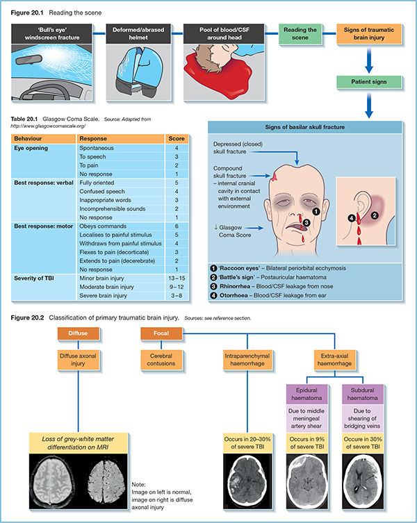 Diagrams show scene reading with markings for ‘Bull’s eye’ windscreen fracture, deformed/abrased helmet, signs of basilar skull fracture, rhinorrhea, et cetera.