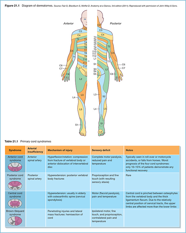 Diagram shows dermatomes with markings for anterior, posterior, C2, C3, C4, C5, C6, C7, C8, T1, T2, T3, T4, T5, T6, T7, T8, T9, T10, T11, T12, S1, S2, S3, S4, S5, L1, L2, L3, L4 and L5.