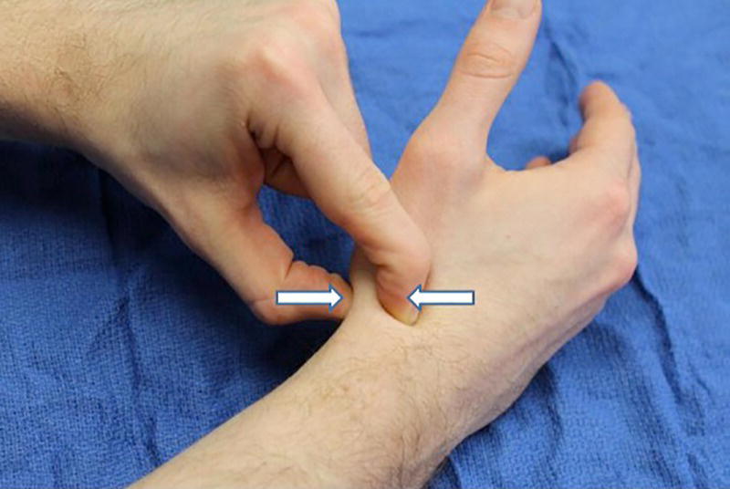 Photo depicts axial load (thumb compression test).