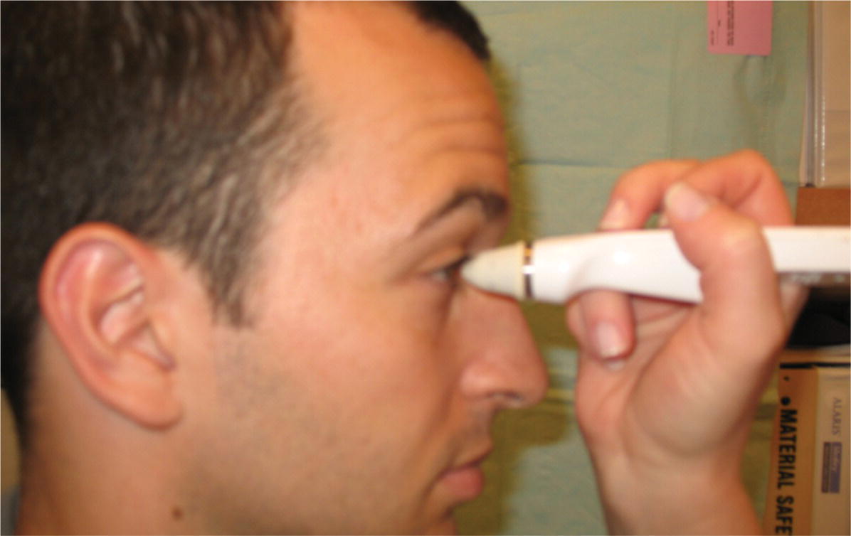 Photo depicts use of the Tono-Pen XL to measure intraocular pressure.