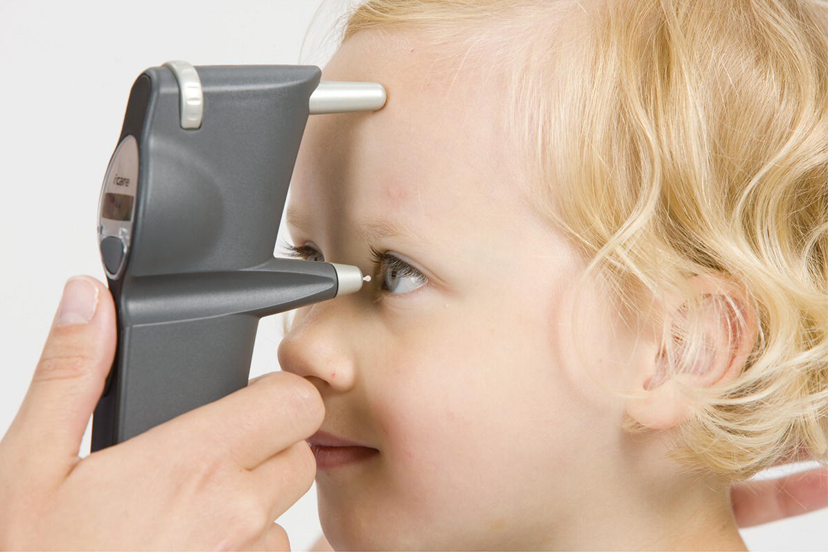Photo depicts use of the Icare tonometer.