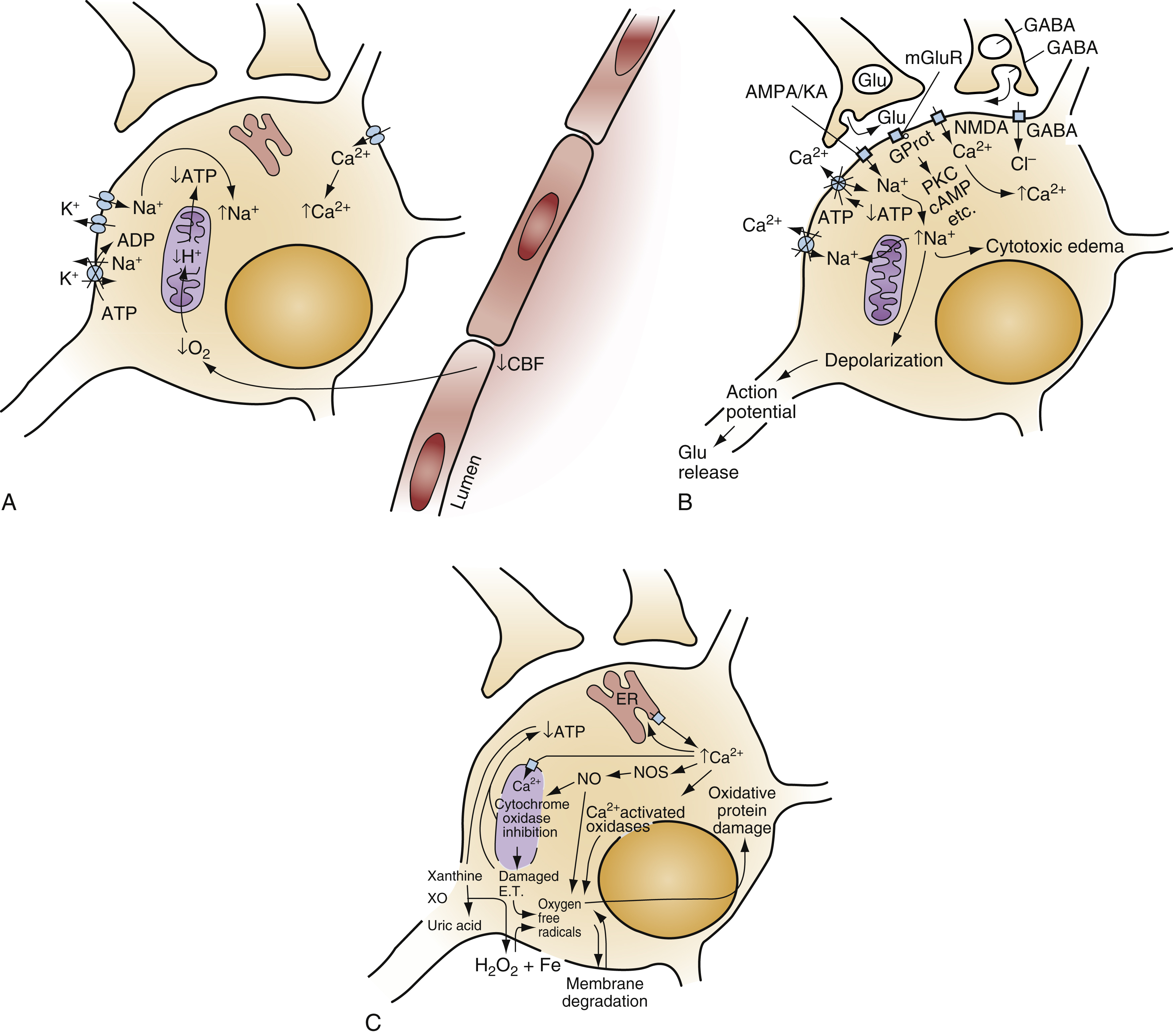 The diagram shows ischemic neuron injury- ATP loss, ion imbalance (A), glutamate toxicity, Ca²⁺ overload (B), and ROS, NO production, membrane damage, cell death (C). The diagram shows is a three-part A, B and C. In panel A, a neuron is shown experiencing reduced cerebral blood flow (CBF), leading to decreased ATP production and failure of ion pumps, resulting in disrupted ionic gradients with sodium (Na⁺), calcium (Ca²⁺), and water influx, and potassium (K⁺) efflux. Panel B depicts the consequences of this disruption, including glutamate release and receptor activation (NMDA, AMPA/kainate), which exacerbate calcium overload, triggering depolarization, cytotoxic edema, and further excitotoxic injury. Panel C shows later stages involving mitochondrial dysfunction, nitric oxide (NO) and reactive oxygen species (ROS) production, membrane degradation due to activation of proteases and lipases, and eventual cell death. The diagram shows panels D–F show ischemic injury, Ca²⁺/ROS trigger apoptosis (D), PARP and protein breakdown drive cell death (E), and inflammation, NO, and CBF drop worsen damage (F). The diagram shows continuation of the ischemic neuronal injury cascade, illustrated in panels D, E, and F. Panel D shows intracellular pathways activated by calcium and free radicals, mitochondrial release of cytochrome c and activation of transcription factors such as MAPK and NF-κB, leading to the expression of apoptotic genes and proteins- Bax/Bcl2 and caspases. Panel E illustrates the execution phase of apoptosis, with PARP activation, calpain-mediated degradation of cytoskeletal and membrane proteins, and nuclear changes culminating in cell death. Panel F depicts the inflammatory and vascular responses, cytokine release, and leukocyte adhesion to endothelium via selectins and integrins, with further endothelial activation, nitric oxide (NO) and endothelin signaling, reduced cerebral blood flow (CBF), and complement activation.