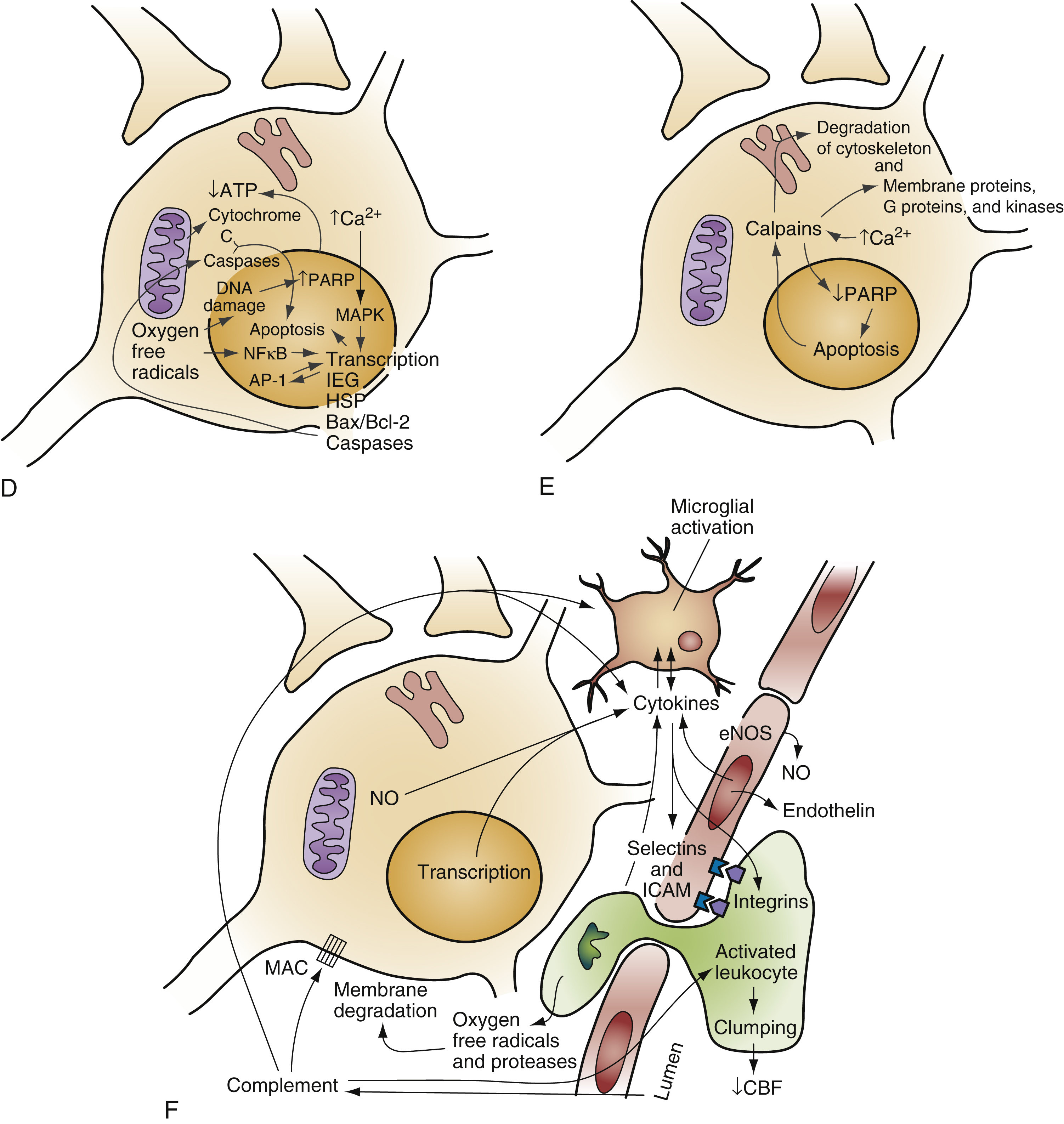 The diagram shows ischemic neuron injury- ATP loss, ion imbalance (A), glutamate toxicity, Ca²⁺ overload (B), and ROS, NO production, membrane damage, cell death (C). The diagram shows is a three-part A, B and C. In panel A, a neuron is shown experiencing reduced cerebral blood flow (CBF), leading to decreased ATP production and failure of ion pumps, resulting in disrupted ionic gradients with sodium (Na⁺), calcium (Ca²⁺), and water influx, and potassium (K⁺) efflux. Panel B depicts the consequences of this disruption, including glutamate release and receptor activation (NMDA, AMPA/kainate), which exacerbate calcium overload, triggering depolarization, cytotoxic edema, and further excitotoxic injury. Panel C shows later stages involving mitochondrial dysfunction, nitric oxide (NO) and reactive oxygen species (ROS) production, membrane degradation due to activation of proteases and lipases, and eventual cell death. The diagram shows panels D–F show ischemic injury, Ca²⁺/ROS trigger apoptosis (D), PARP and protein breakdown drive cell death (E), and inflammation, NO, and CBF drop worsen damage (F). The diagram shows continuation of the ischemic neuronal injury cascade, illustrated in panels D, E, and F. Panel D shows intracellular pathways activated by calcium and free radicals, mitochondrial release of cytochrome c and activation of transcription factors such as MAPK and NF-κB, leading to the expression of apoptotic genes and proteins- Bax/Bcl2 and caspases. Panel E illustrates the execution phase of apoptosis, with PARP activation, calpain-mediated degradation of cytoskeletal and membrane proteins, and nuclear changes culminating in cell death. Panel F depicts the inflammatory and vascular responses, cytokine release, and leukocyte adhesion to endothelium via selectins and integrins, with further endothelial activation, nitric oxide (NO) and endothelin signaling, reduced cerebral blood flow (CBF), and complement activation.