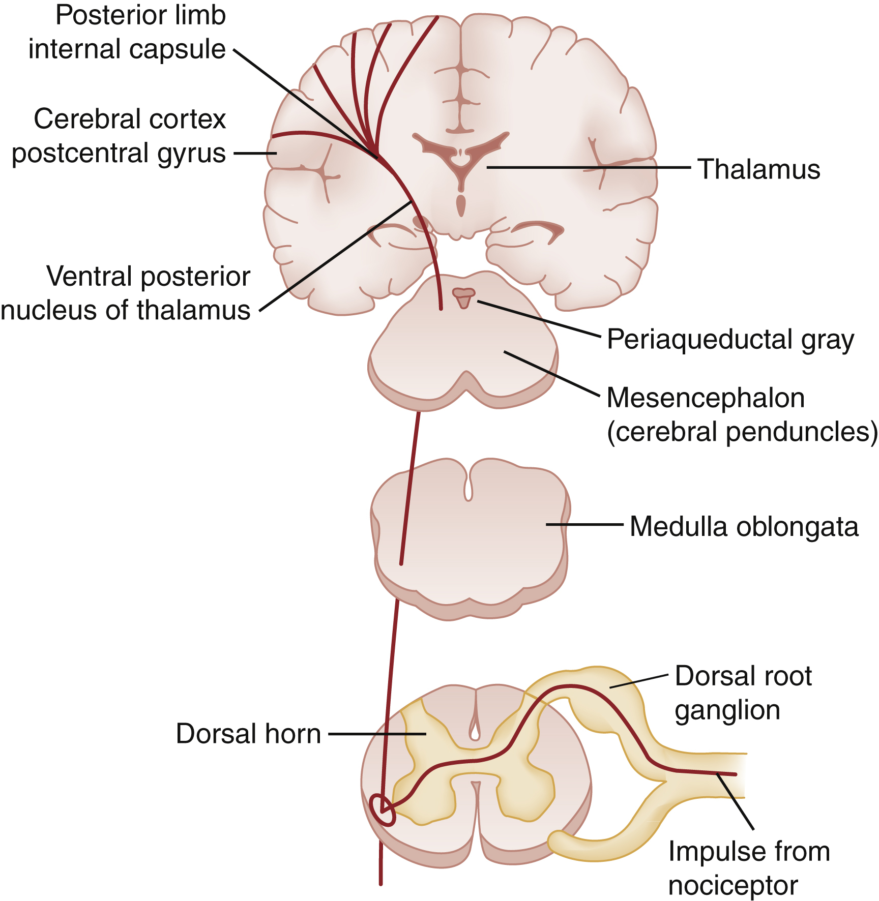 The diagram shows pain signals start at nociceptors, pass through the dorsal root ganglion and dorsal horn, then ascend via medulla, midbrain, and thalamus to the cortex through the internal capsule. The diagram shows the ascending neural pathway of pain signals from peripheral sensory input to the brain. It begins with an impulse from a nociceptor, which travels through the dorsal root ganglion into the dorsal horn of the spinal cord. From there, the signal ascends through the medulla oblongata, mesencephalon (notably the cerebral peduncles), and periaqueductal gray, continuing upward to the thalamus, specifically the ventral posterior nucleus. The pathway proceeds through the posterior limb of the internal capsule and culminates in the cerebral cortex of the postcentral gyrus, where pain is consciously perceived.