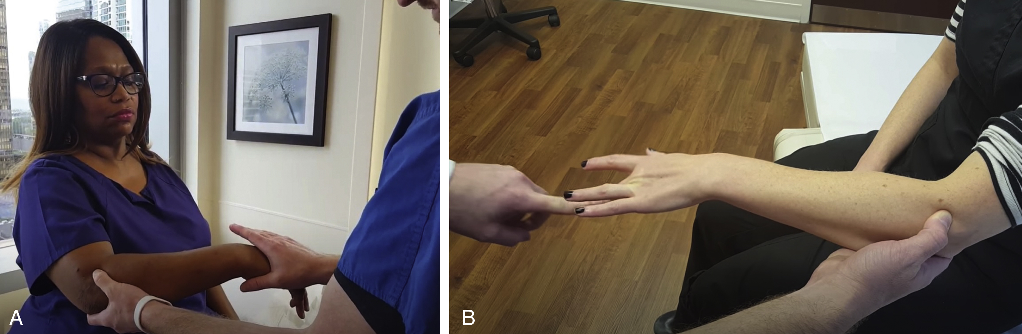 A set of two photograph shows tests for lateral epicondylitis: A Cozen’s test with resisted wrist extension, B Maudsley’s test with resisted middle finger extension, both assessing pain response. A set of two photograph shows clinical tests used to evaluate lateral epicondylitis. In A, Cozen’s test is performed as the patient makes a fist, pronates the forearm, and extends the wrist against resistance applied by the clinician holding the patient’s forearm. In B, Maudsley’s test is demonstrated, where the clinician resists extension of the patient’s middle finger while stabilizing the wrist and forearm, assessing for pain associated with lateral epicondylitis.
