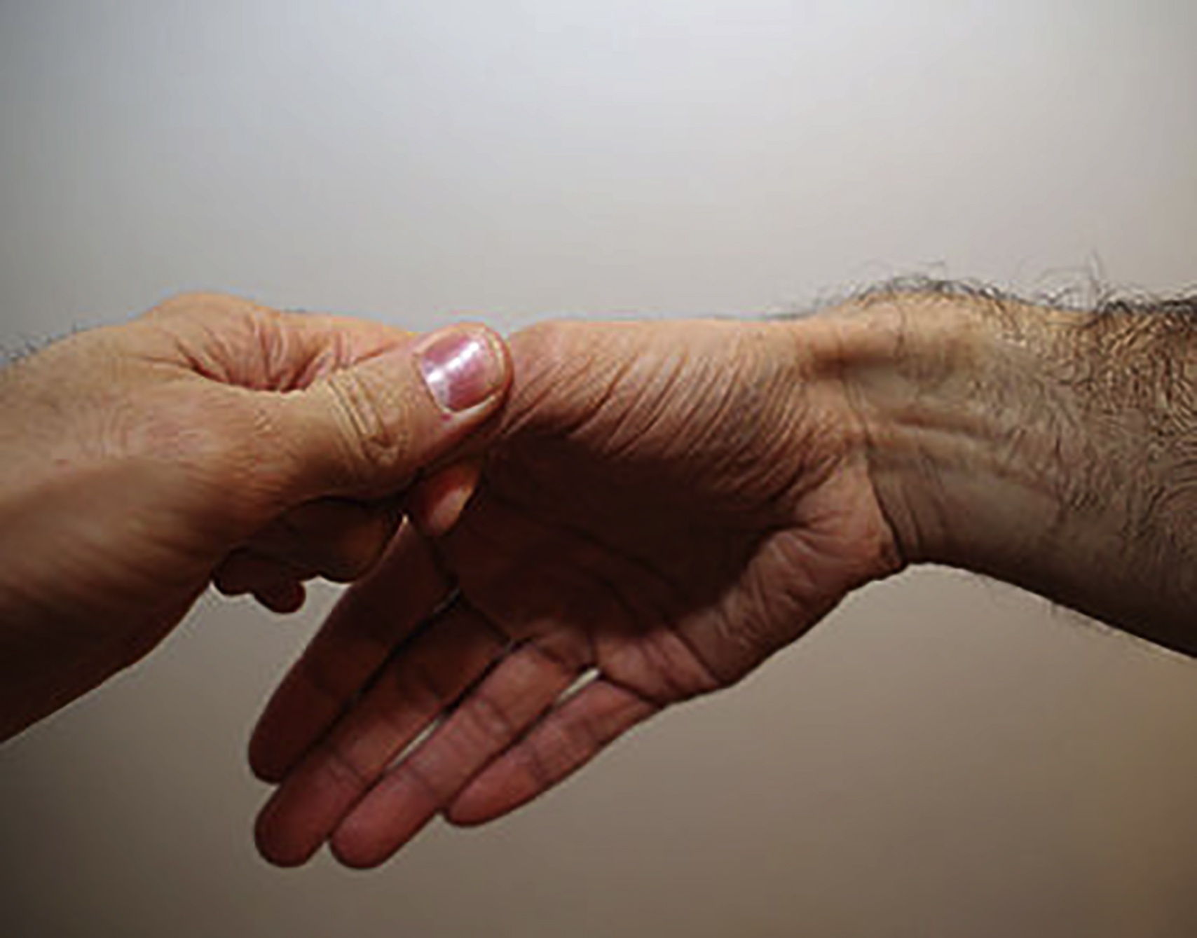 The photograph shows finkelstein’s test for de Quervain’s tenosynovitis, with the thumb outside the fist and the wrist deviated toward the ulna to check for pain along thumb tendons.
