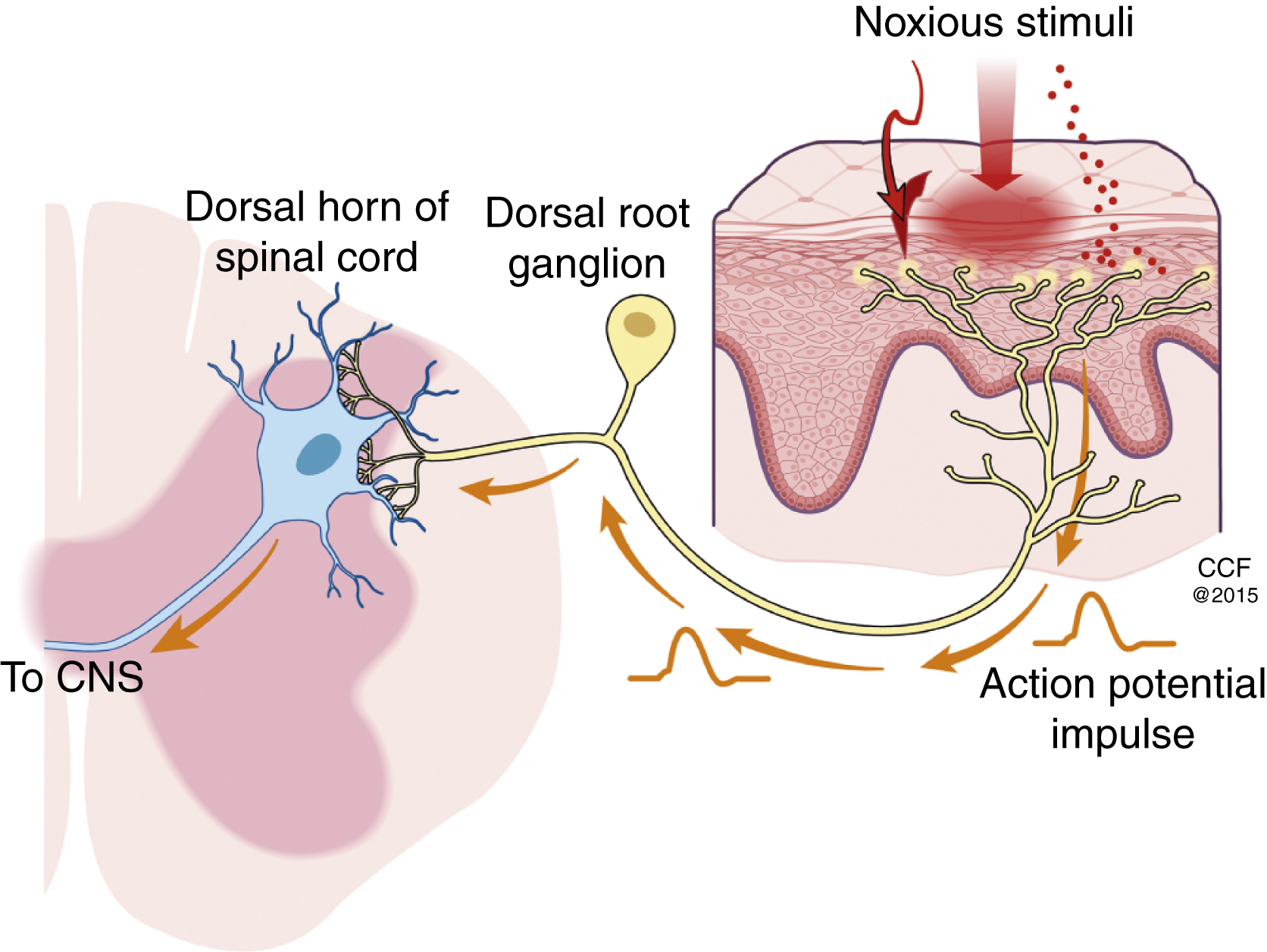 The diagram shows noxious stimuli activating skin nociceptors, sending an action potential through the dorsal root ganglion to the dorsal horn of the spinal cord and then to the CNS. The diagram shows the pathway of nociceptors in response to noxious stimuli. A section of skin is shown where noxious stimuli trigger sensory nerve endings. These nerve endings generate an action potential impulse that travels along a sensory neuron. The neuron passes through the dorsal root ganglion, which is shown as a yellow oval structure near the spinal cord. From the dorsal root ganglion, the signal enters the dorsal horn of the spinal cord and continues toward the central nervous system, labeled CNS, shows the transmission of pain signals for processing.
