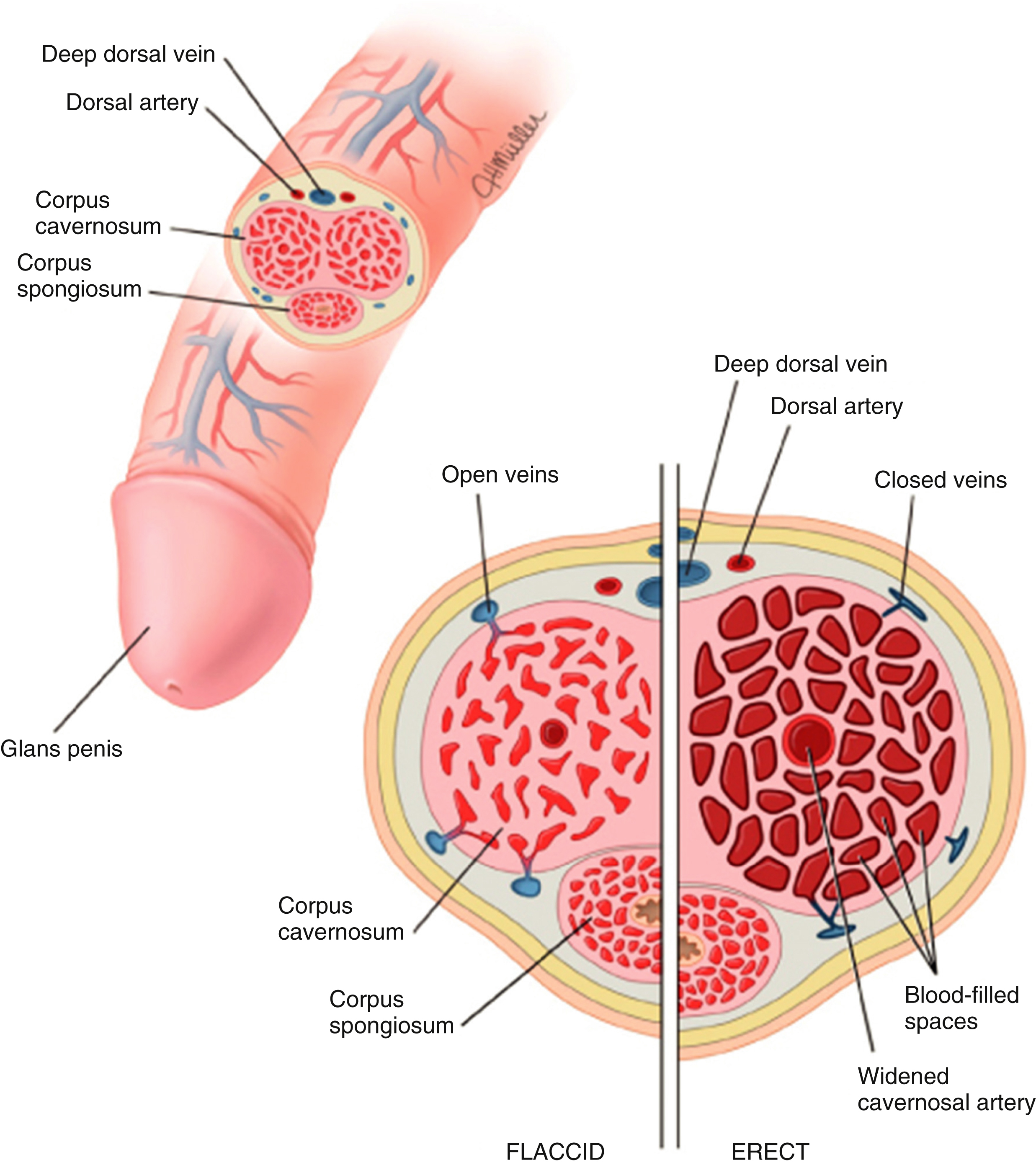 The diagram shows penis structure flaccid and erect. Longitudinal view labels glans, corpus spongiosum, corpus cavernosum, dorsal artery, deep dorsal vein. Cross-sections show blood flow changes. The diagram of the penis shows its structure in both flaccid and erect states. The upper part of the diagram illustrates a longitudinal view of the penis, identifying the glans penis, corpus spongiosum, corpus cavernosum, dorsal artery, and deep dorsal vein. The lower part of the diagram presents a cross-sectional view comparing the flaccid and erect states. In the flaccid state, the corpus cavernosum and corpus spongiosum are visible with open veins. In the erect state, the corpus cavernosum shows widened cavernosal arteries and blood-filled spaces, with closed veins, while the corpus spongiosum is also depicted alongside the deep dorsal vein and dorsal artery.