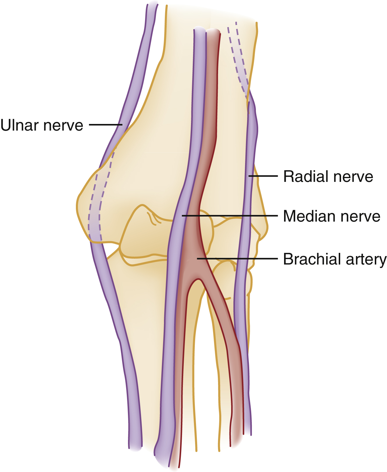 The diagram shows volar view of left elbow, outlines humerus, ulna, radius, highlights ulnar nerve medially, radial nerve, median nerve medial to brachial artery, and its distal branches. The diagram shows the neurovascular structures of the elbow region, specifically showsing the volar (anterior) surface of the left elbow. The ulnar nerve is visible on the medial side of the elbow. Centrally, running down the arm, are the radial nerve, median nerve, and the brachial artery, with the median nerve positioned medially to the brachial artery.