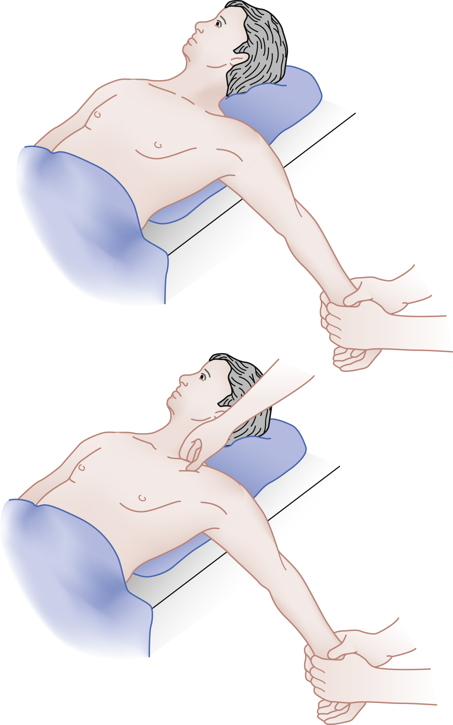 The Illustration shows SC joint reduction, Top panel shows a patient supine with back support. Bottom panel shows second person applies pressure to clavicle and neck to aid reduction. The Illustration shows the procedure for reducing dislocated sternoclavicular joints. The top panel shows a patient lying supine with a rolled sheet placed under their upper back to elevate the shoulders. The bottom panel shows the same setup, but now a second person is applying posterior pressure with one hand on the medial end of the patient's right clavicle.