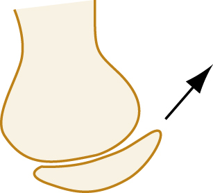 Image, AltText currently not available