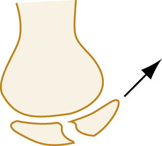 Image, AltText currently not available