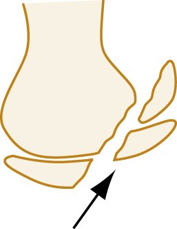 Image, AltText currently not available