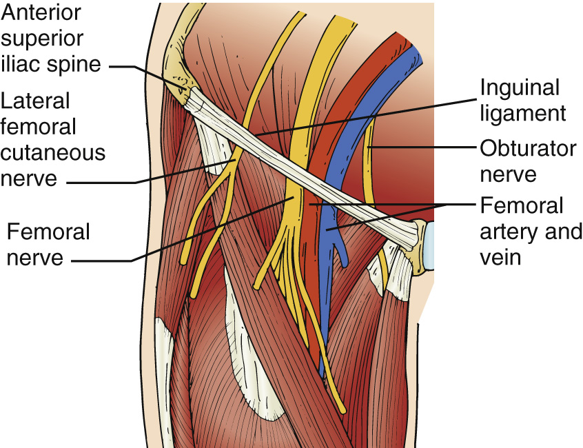 A labeled anatomical illustration of the femoral nerve region.